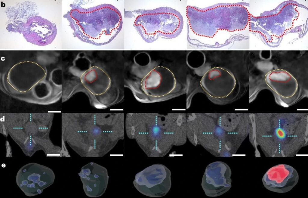 Nanobots for bladder cancer treatment, promising high efficacy and targeted delivery