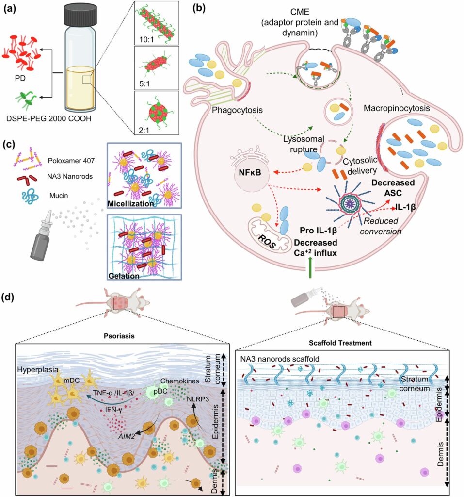 Sprayable psoriasis drug delivery system uses ‘trojan horse’ style of nanoparticle