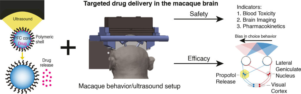 Ultrasound-activated nanoparticles deliver drugs to targeted brain regions