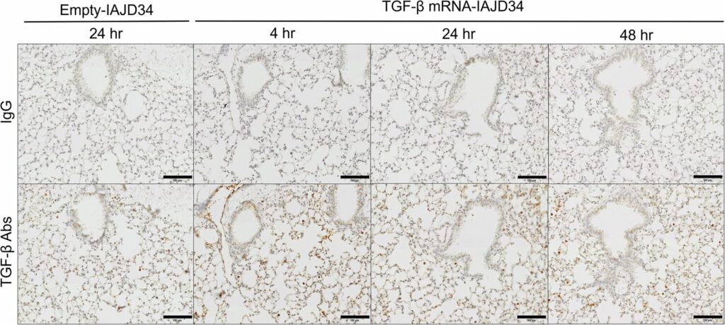 Combined organ-specific mRNA and lipid nanoparticle therapy could repair damaged lungs