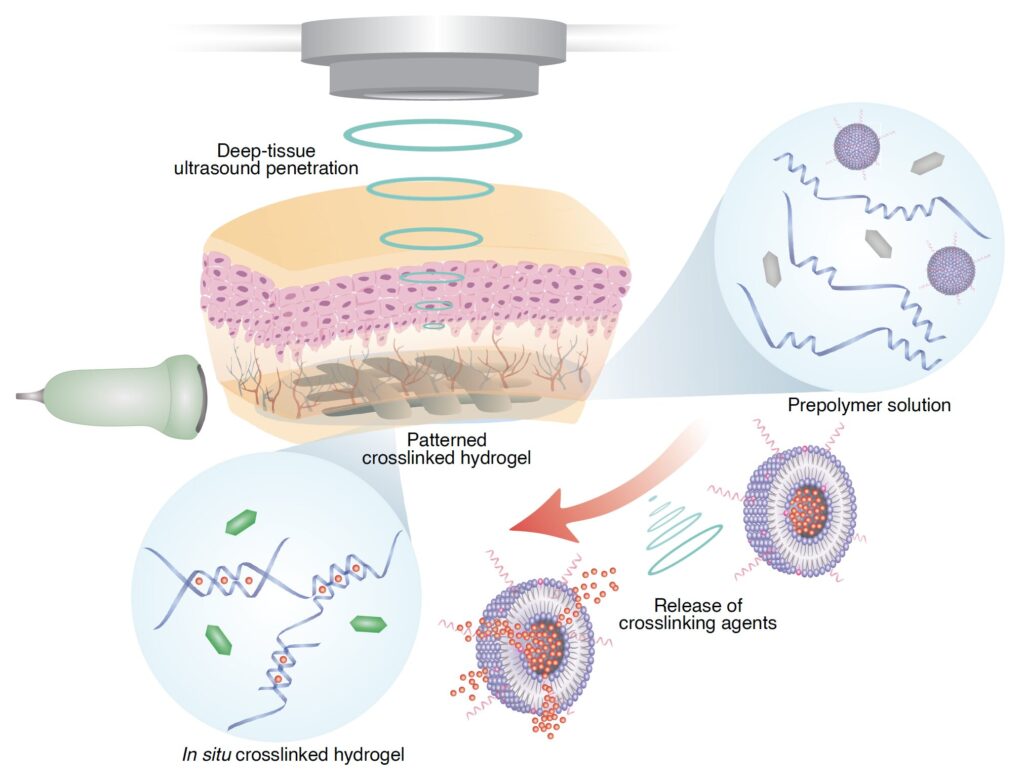 In vivo 3D printing using sound holds promise for precise drug delivery, wound healing and more