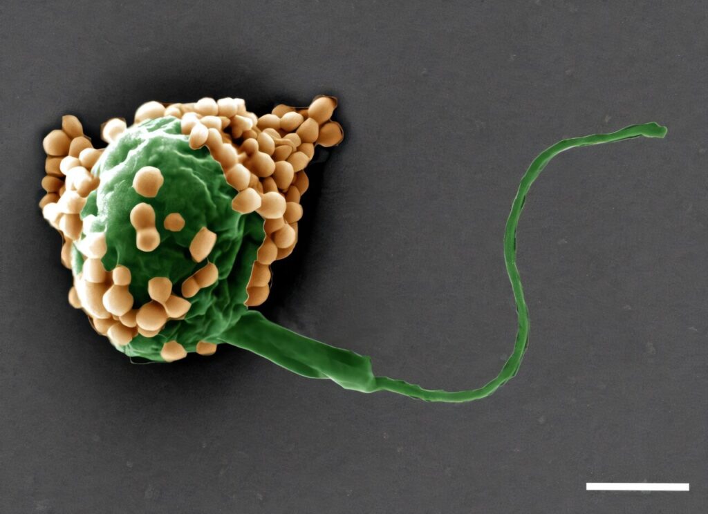 Breathable algae offers a new path